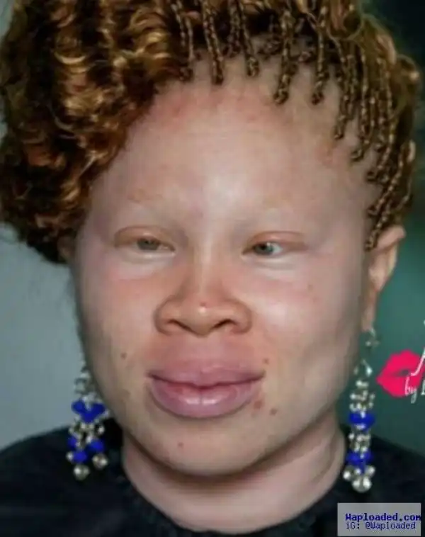 Question Of The Day: Can You Date An Albino? – Get In Here